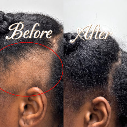 Leapure Hair Growth Oil | 100% Natural Formula for Longer, Stronger & Healthier Hair